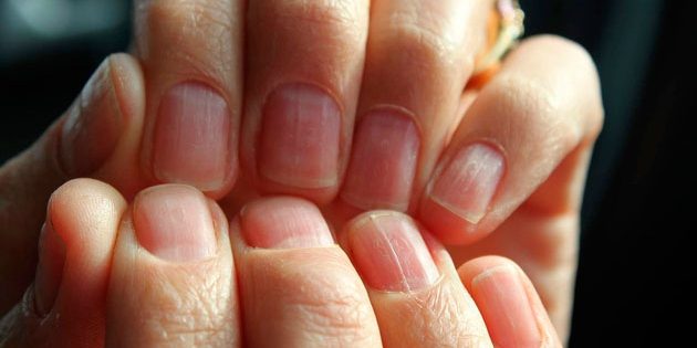 Продольные бороздки Продольные бороздки