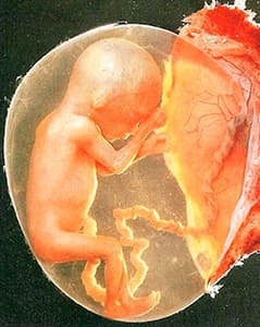 беременность 4 месяца фото плода