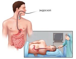 Проведение процедуры