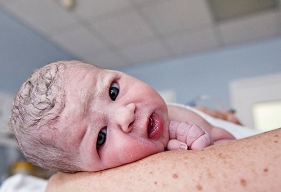 Как выглядят новорожденные дети в первые дни