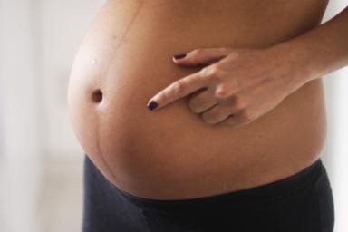 Полоска на животе при беременности фото