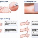 Как делать манту – Как делают Манту детям и взрослым: алгоритм и правила